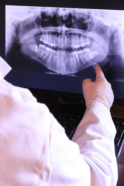 Best Emergency Root Canal Treatment in Dennison, OH